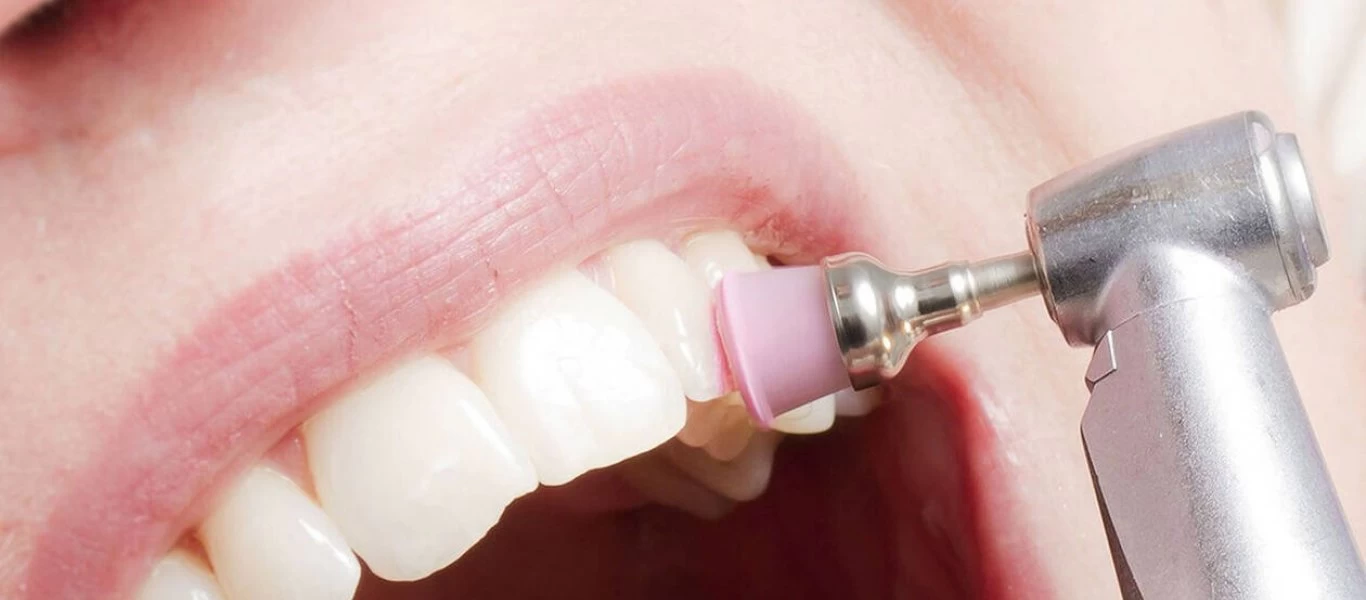 Έτσι θα αφαιρέσετε την οδοντική πλάκα χωρίς να πάτε στον οδοντίατρο